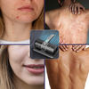 DreamCleanse™ - Mite Binder