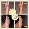NoCracks™ - Foot Cream