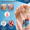 ToePerfect™ - Heals toenails and hangnails [last day discount]