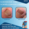 ToePerfect™ - Heals toenails and hangnails [last day discount]