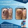 ToePerfect™ - Heals toenails and hangnails [last day discount]
