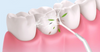 DentaJet™ - The ultimate solution for a radiant smile