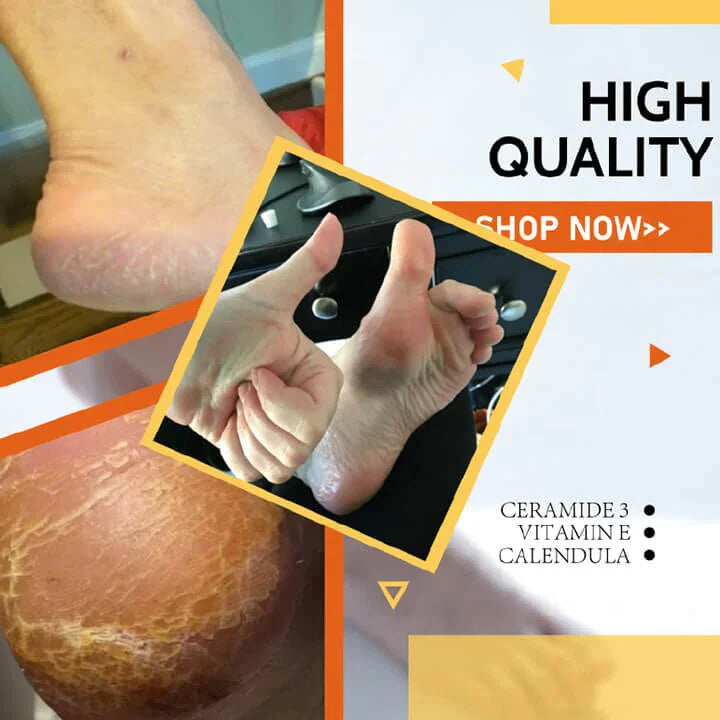 NoCracks™ - Foot Cream