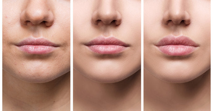 InstantLipPlumper™ - Fuller, lusher lips in an instant | 1+2 FREE【Last day discount】