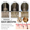 HairMassageComb™ - Put an end to hair loss!