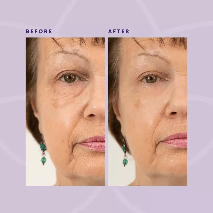 1+1 FREE | MiracleEye™ | Wrinkle Eraser Firming Eye Cream
