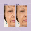 MiracleEye™ - Wrinkle Eraser Firming Eye Cream