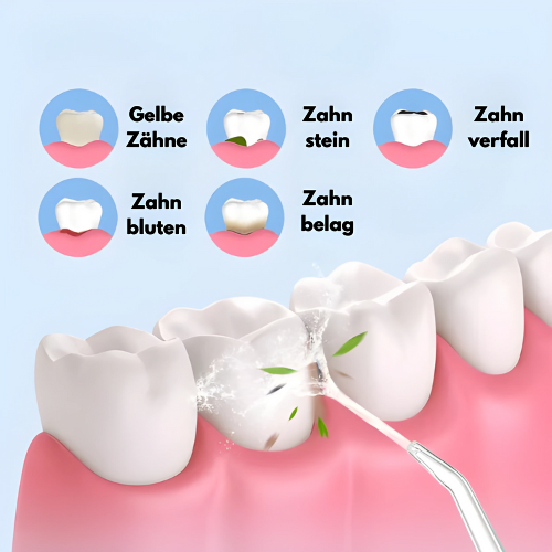 CleanSmile™ - water flosser for oral hygiene [last day discount]