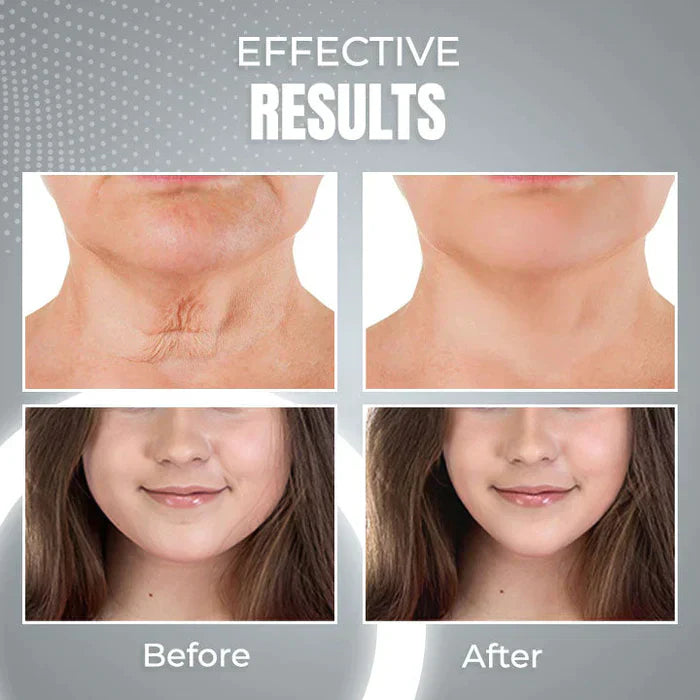 YoungSkin™ 2in1 EMS ANTI-AGE DEVICE