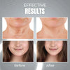 YoungSkin™ 2in1 EMS ANTI-AGE DEVICE