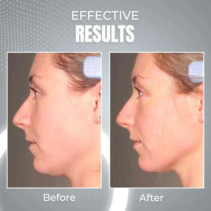 YoungSkin™ 2in1 EMS ANTI-AGE DEVICE
