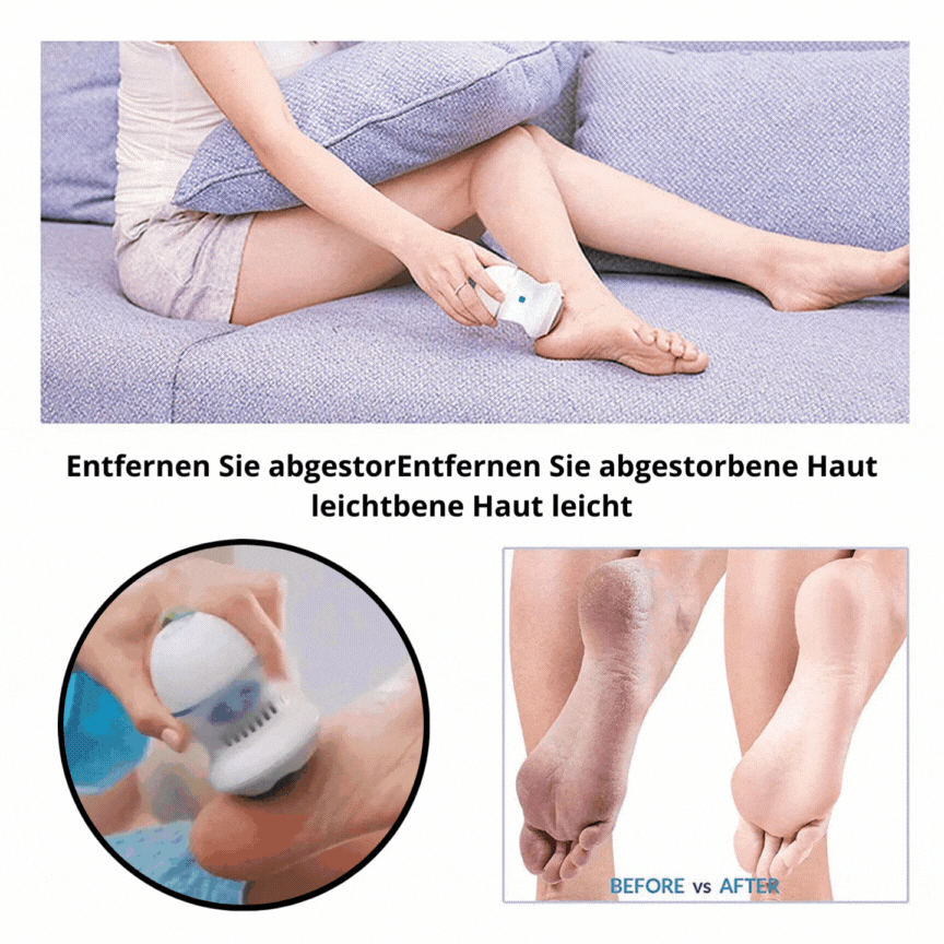 SoleSmooth™ - Electric foot grinder