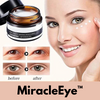 MiracleEye™ - Wrinkle Eraser Firming Eye Cream