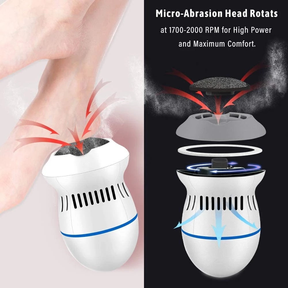 SoleSmooth™ - Electric foot grinder