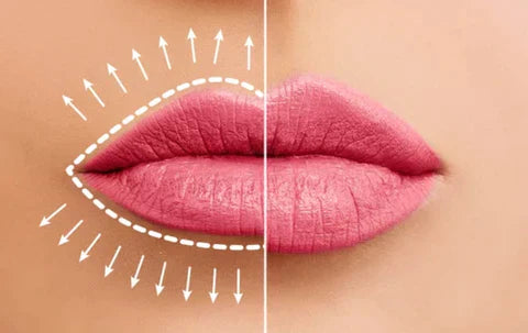 InstantLipPlumper™ - Fuller, lusher lips in an instant | 1+2 FREE【Last day discount】