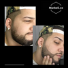 BeardPro™ - Beard pen filler