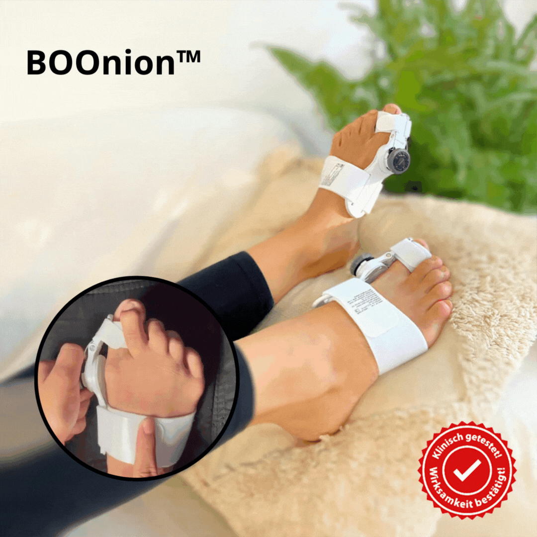 BOOnion™ - Orthopaedic bunion correction hallux valgus for pain relief [last day discount]