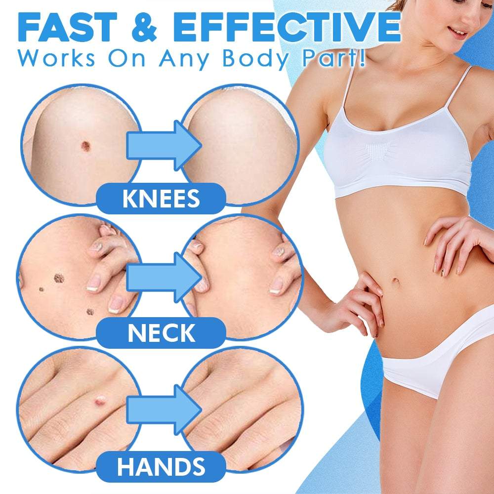 FlawFix™ - Stalk wart removal kit
