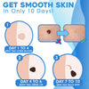 FlawFix™ - Stalk wart removal kit