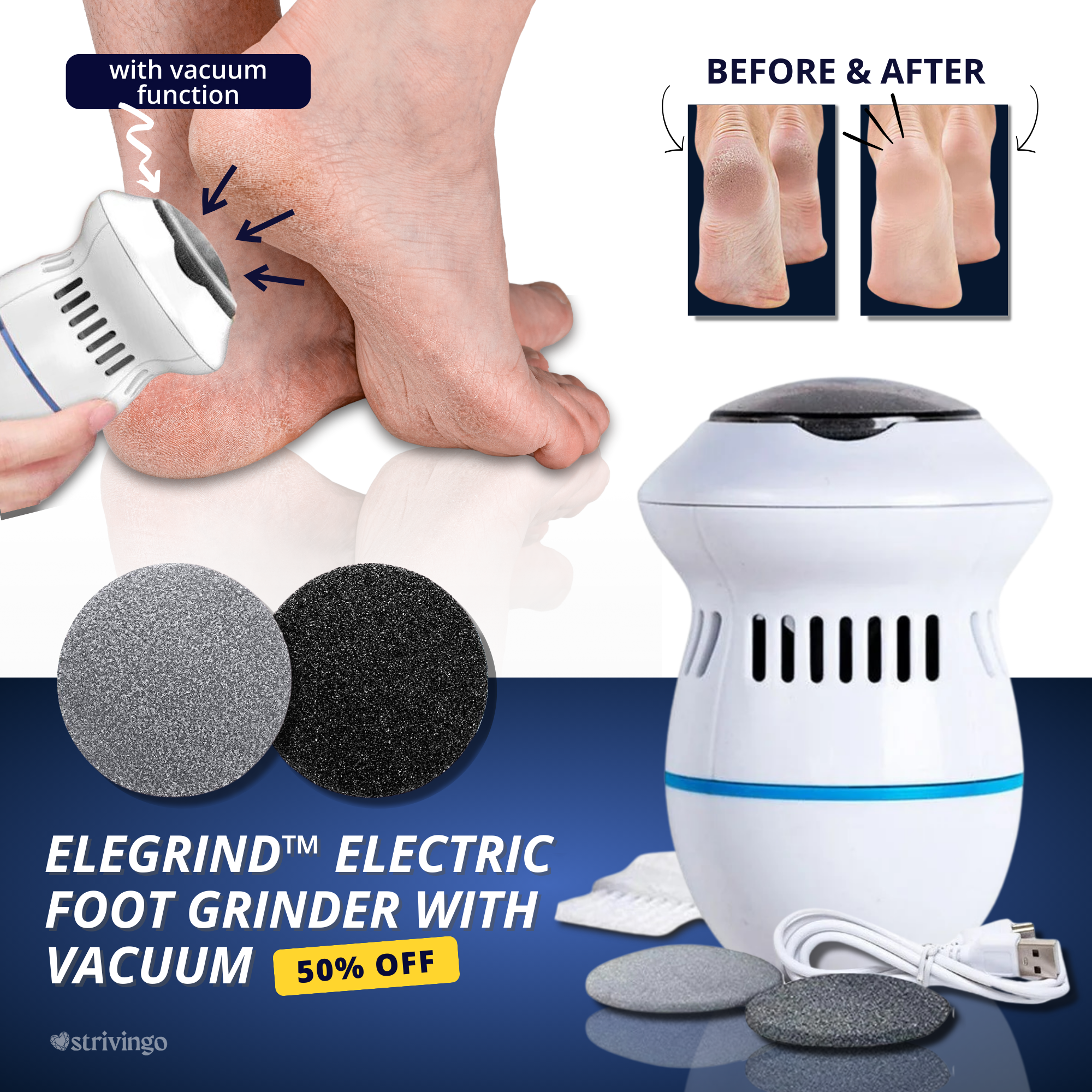 THIS WEEK ONLY | Elegrind™ Electric Foot Grinder with Vacuum | incl. 2 Grinder Heads