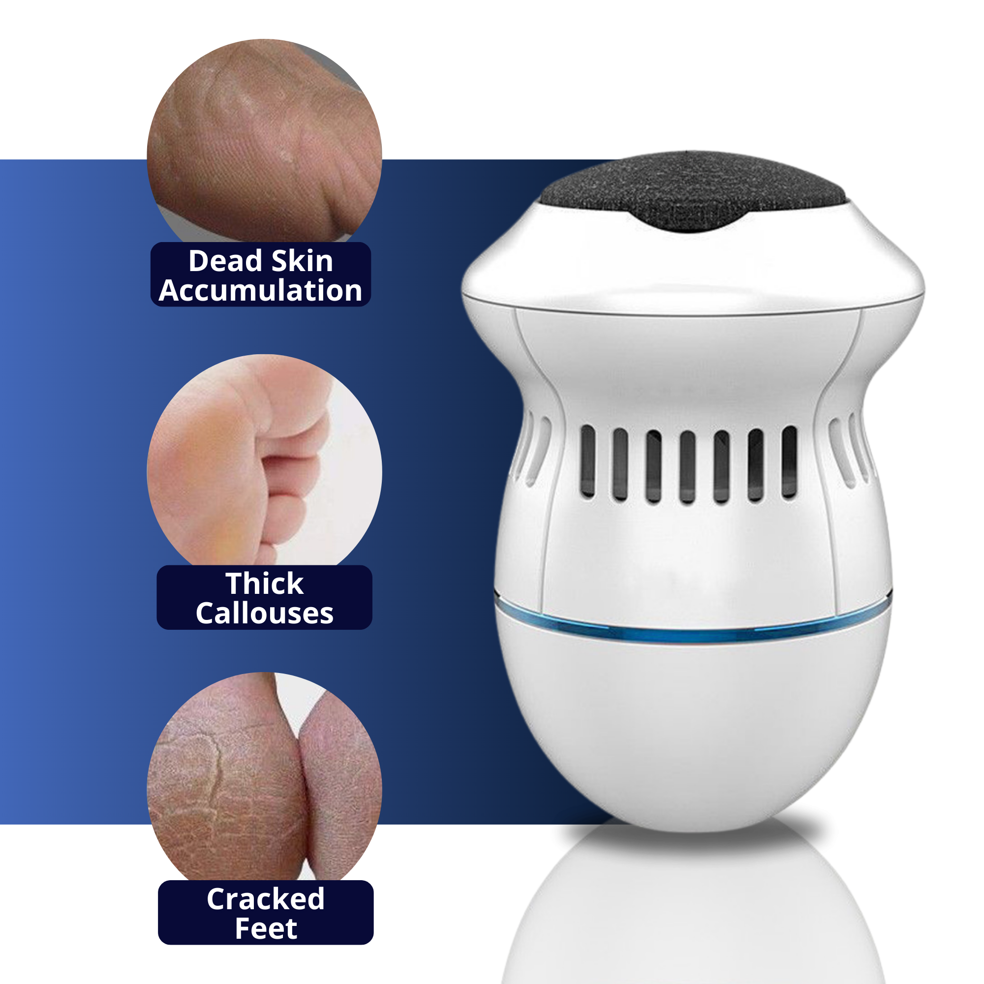 THIS WEEK ONLY | Elegrind™ Electric Foot Grinder with Vacuum | incl. 2 Grinder Heads