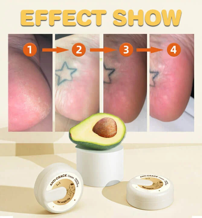NoCracks™ - Foot Cream