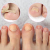 Nail Plaster™ - Painless nail care