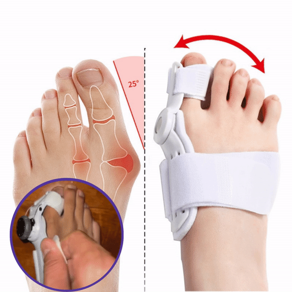 AdjustableToe™ universal toe corrector 1 + 1 FREE【Last day discount】