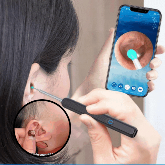 CleanEars™ - 360° wireless smart ear cleaner with camera for effortless ear cleaning