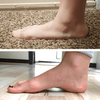 StepRelief™ | Orthopedic foot arch support
