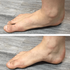 StepRelief™ | Orthopedic foot arch support