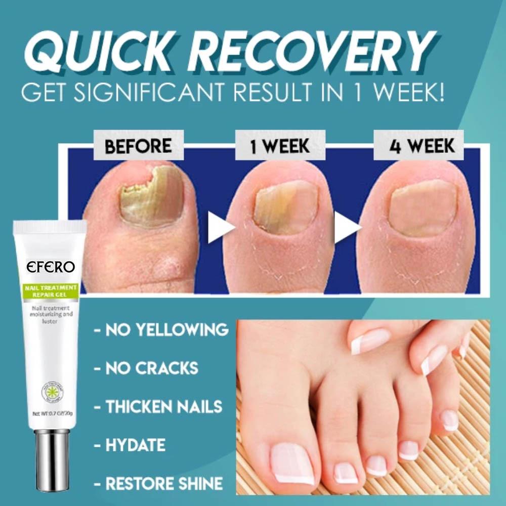 Nail Repair™ - Fast and effective results!