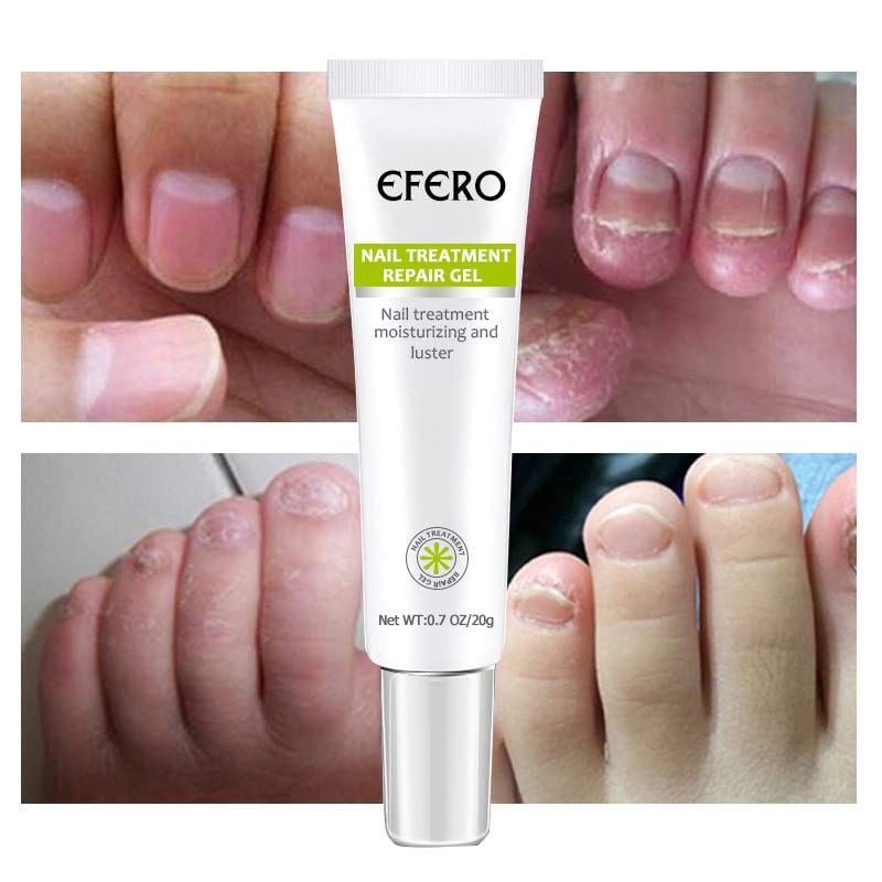 Nail Repair™ - Fast and effective results!