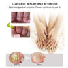 Nail Repair™ - Fast and effective results!