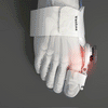 BOOnion™ - Orthopaedic bunion correction hallux valgus for pain relief [last day discount]