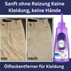 () StainRemover™ - Remove stains in seconds!