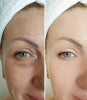 1+1 FREE | Auquest® | Anti Aging & Wrinkle Removing Eye Cream【Last day discount】